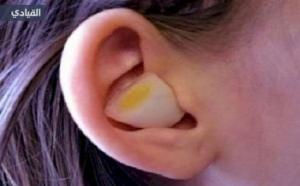 هل فكرت يوماً ماذا سيحدث إذا وضعت البصل في أذنك؟