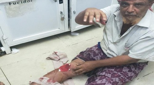 شهداء وجرحى من المدنيين بقصف قوات الحماية الرئاسية بدار سعد