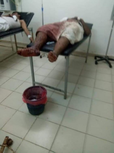 قتلى وجرحى لمليشيا الإخوان تصل مستشفى مودية ب#أبيـن