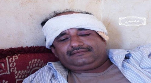 قناص #حوثي يستهدف مواطن بطلقة اصابته برأسه في منطقة حجر #الضـالع