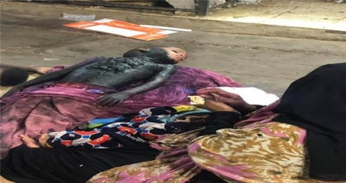 ضبط امرأة تمارس أغرب وأبشع وسيلة للتسول في #العاصمة_عدن (شاهد الصورة)