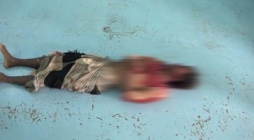 #الحديدة.. استشهاد مواطن برصاص قناص حوثي بالتحيتا