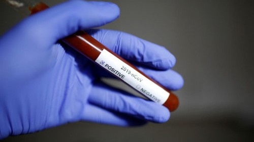 شركة أميركية تختبر عقاراً قد ينقذ البشرية من فيروس كورونا