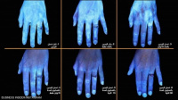 6 صور تكشف ما يفعله الماء والصابون بجراثيم اليد
