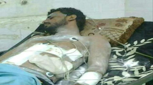مقتل قائد النجدة في محافظة أبين مساء اليوم خلال مواجهات مع القوات الجنوبية
