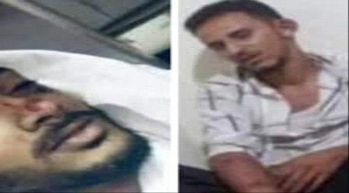 الطب الشرعي يكشف سبب وفاة الشاب الأغبري