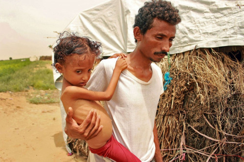 الانهيار غير المسبوق للريال اليمني يفاقم الأزمة الإنسانية