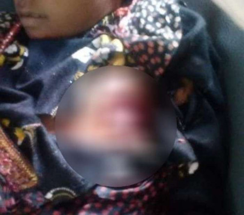 الحوثيون يرتكبون جرائم بحق أهالي وأطفال حيس (صور)