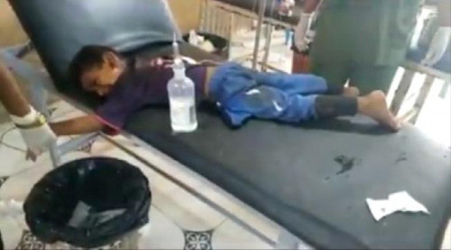 مجزرة حوثية دامية.. استشهاد وإصابة 17 مدنياً بينهم نساء وأطفال في الحديدة "الاسماء"