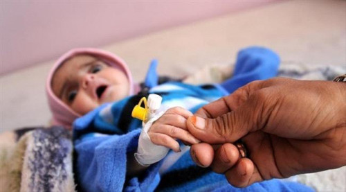 منظمة دولية تؤكد ارتفاع "سوء التغذية" للأطفال في اليمن إلى نسبة قياسية