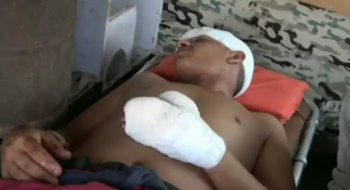 مليشيا الحوثي تستهدف سوقا بالدريهمي بطائرة مفخخة