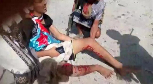 عنف مليشيا الإخوان امام تظاهرات شبوة السلمية جريمة بحق الانسانية يشاهدها العالم