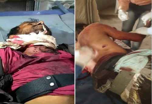 الضالع.. 480 خرقاً لمليشيات الحوثي منذ بدء الهدنة بينها عمليتي قنص راح ضحيتها استشهاد مدنيين أشقاء