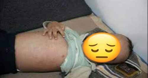 بعد تزايد حالات الإصابة بالحصبة.. وزارة الصحة تعلن تنفيذ حملة طارئة لمكافحة المرض