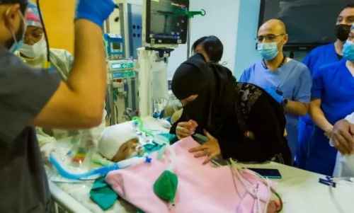 نجاح عملية فصل التوأم السيامي &ldquo;يوسف وياسين&rdquo;