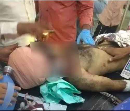 سقوط شهيد وجريح باستهداف مليشيات الحوثي لمواقع القوات الجنوبية والمشتركة شمال الضالع&nbsp;